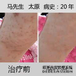 1-1503150ZU0593